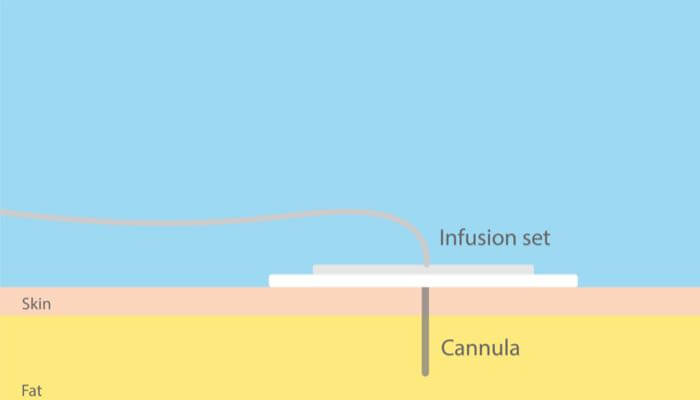 GettyImages-1366611679_700x400 GettyImages-1366611679_700x400