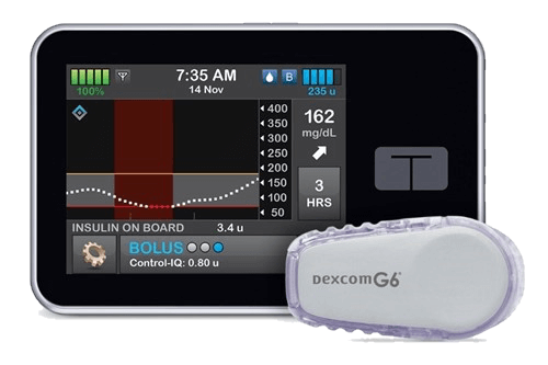 t_slim-x2-insulin-pump-with-control-iq